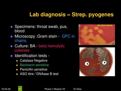 streptococcus pyogenes biochemical test|Laboratory Diagnosis of Streptococcus pyogenes (group A .